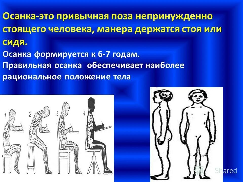 Привычное положение тела непринужденно стоящего. Привычное положение тела непринужденно стоящего. Осанка это непринуждённое привычное положение. Правильная осанка. Виз это положение тела какое.