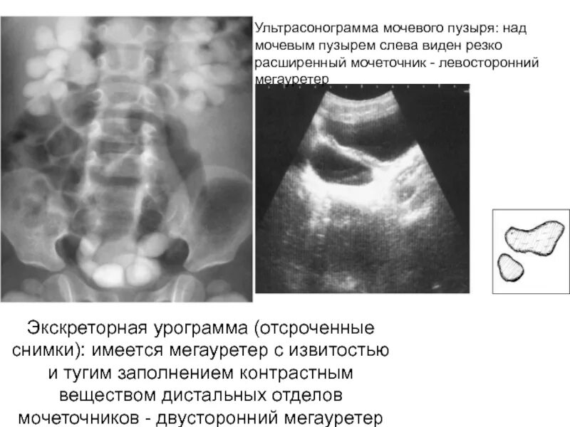 Артрит пальцев рук: причины, симптомы и лечение