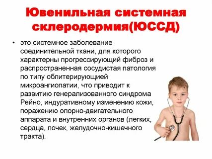 Склероз кожи
