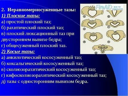 Размеры плоского таза