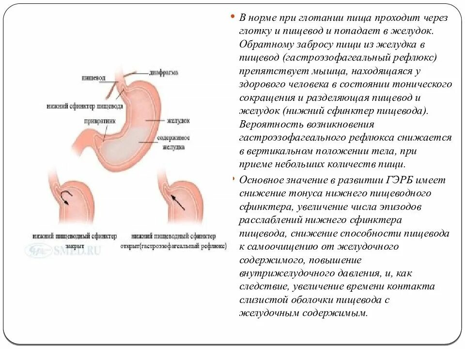 Пищи по пищеводу причины