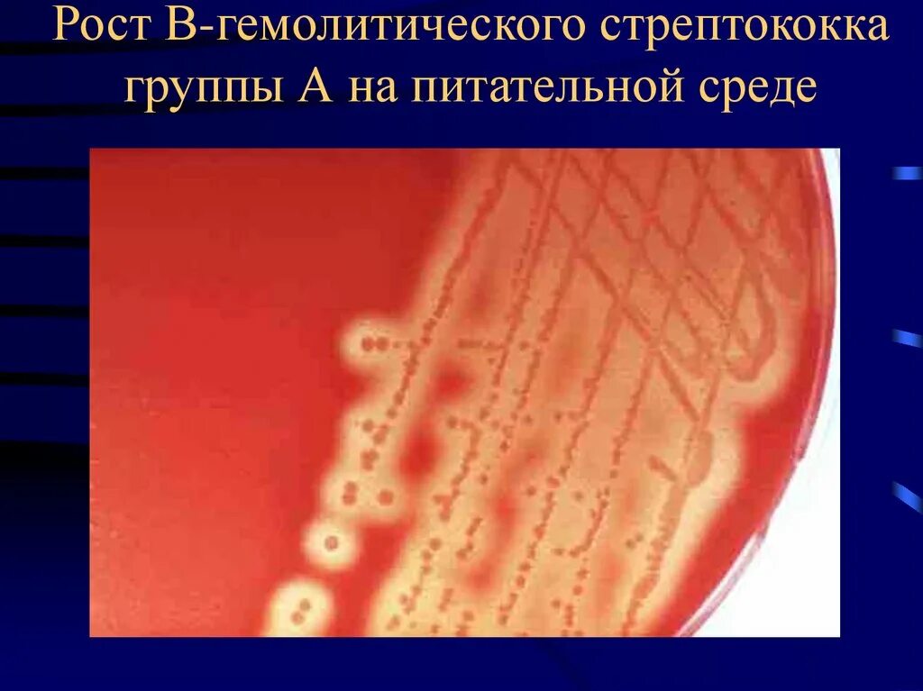 Возбудитель - бета-гемолитический стрептококк группы а. Β гемолитические стрептококки. Гноеродные гемологические стрептококки. Гемолитический стафилококк. Альфа гемолиз стрептококков.