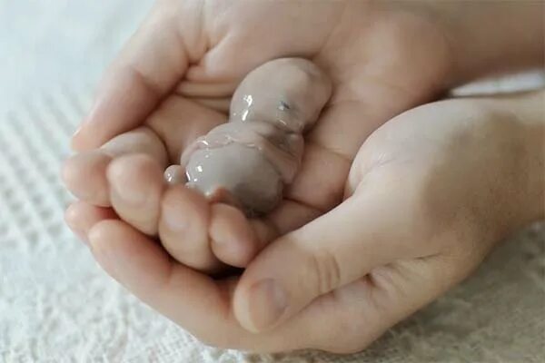 Как выглядит ребенок а4 Как выглядит ребенок в 23 89 фото