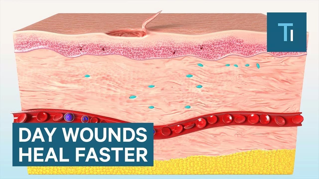 Wound healing. Процесс заживления ран схема. Wound healing. Scratch assay. Scratch‑wound assay.