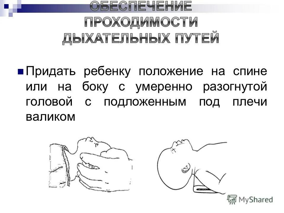 Проведение сердечно легочной реанимации ребенку. Положение рук при слр у детей. слр у новорожденных детей алгоритм. сердечно сосудистая реанимация у детей.