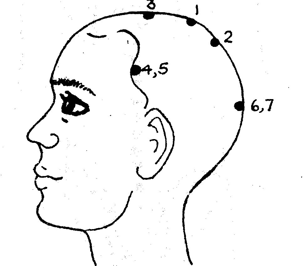 Болезненные точки на голове. Точки на голове для массажа. Точечный массаж головы. Биологические точки на голове. Акупунктурные точки на голове.