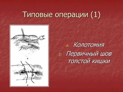 Типичная операция
