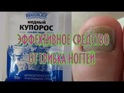 Медный купорос от грибка