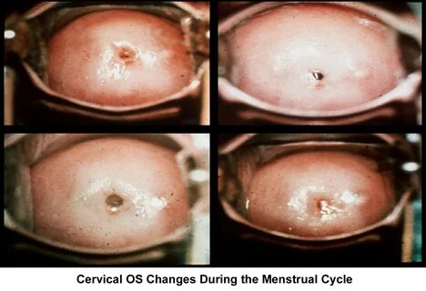 Cervix At Ovulation.