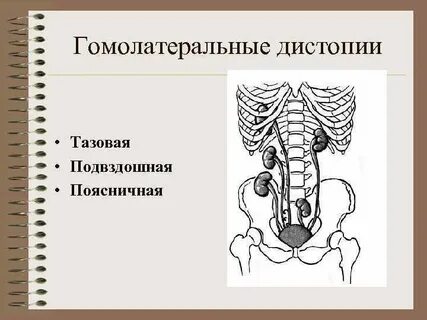 Тазовая дистопия