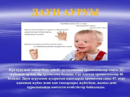 Даун синдромының жыныстық аспектісі