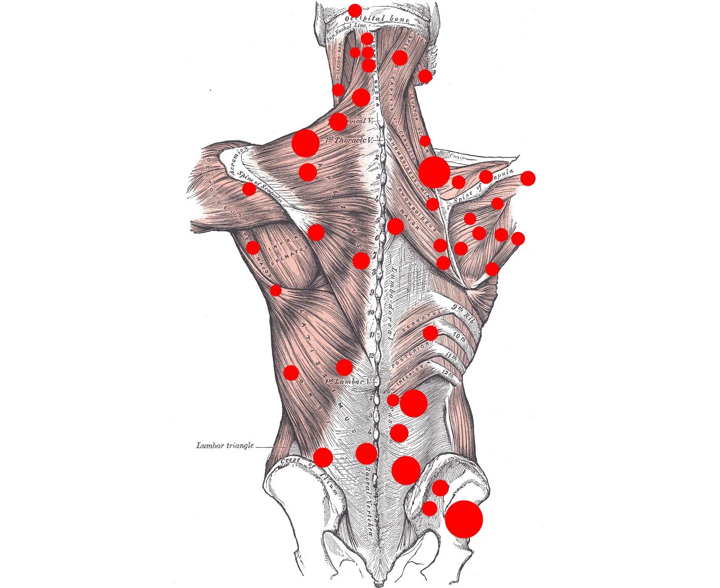 Триггерные точки это простыми словами. Миофасциальный синдром триггерные точки. Миофасциальные болевые триггерные точки тела человека. Триггерные точки в мышцах спины. Мышцы спины человека триггерные точки.