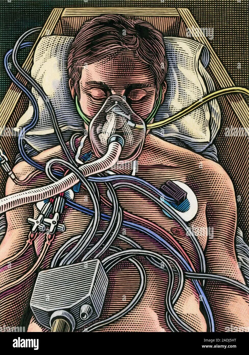 Первая кома техника. Кома рисунок.