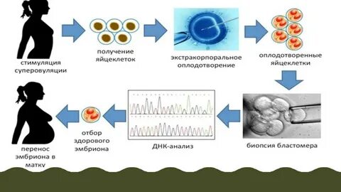 Криоперенос очередь