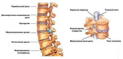Шишки возле позвоночника