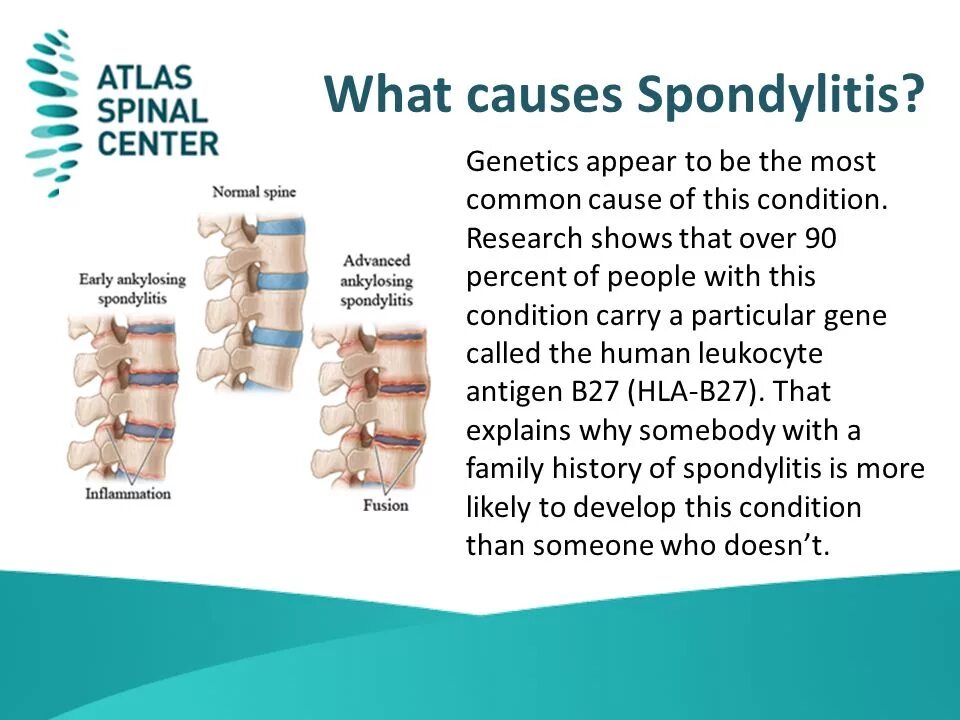 Sleep disorder. The most common causes of. Lung cancer статистика. Ileus is conservative. Slow loading web page.