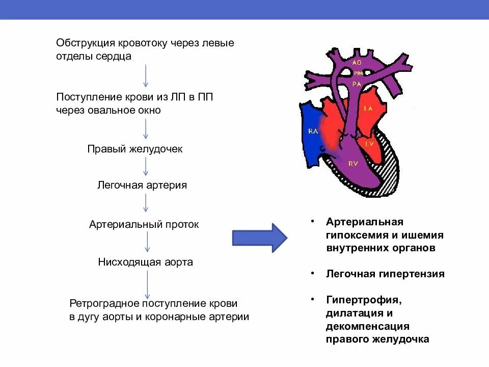 5 врожденных пороков сердца. Патогенез впс. пороки сердца блок схема. патогенез врожденных пороков сердца. врожденные пороки сердца у детей патогенез.