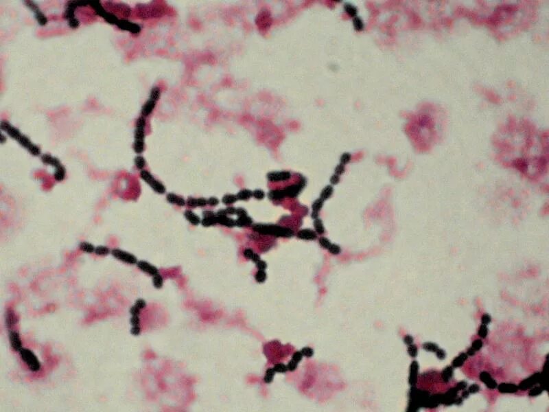 Streptococcus мазок. Streptococcus pyogenes микробиология. стрептококк агалактия под микроскопом. стрептококк pyogenes в мазке. streptococcus pyogenes мазок.