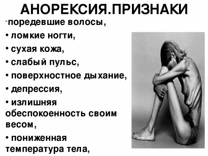 Симптомы анорексии. Симптомы анорексии
