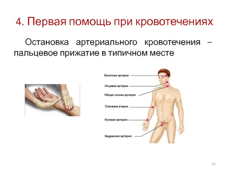 Способы остановки кровотечения пальцевое прижатие артерии. Точки прижатия артерий для остановки артериального кровотечения. Артериальное кровотечение первая помощь. Пальцевое прижатие кровотечений. Остановка кровотечения пальцевое прижатие.