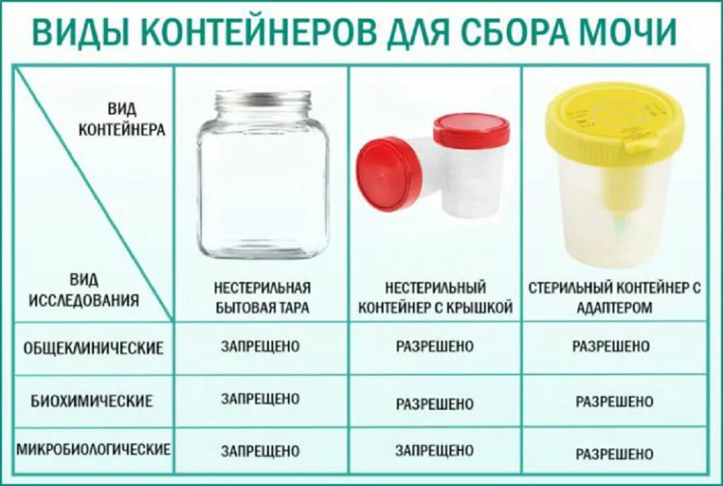 Сколько времени нельзя мочить. Баночка для анализов мочи. Сколько нужно мочи для анализа. Хранение мочи для анализа. Сояа для обзего анализа.