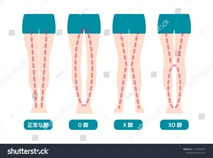 Что значит leg