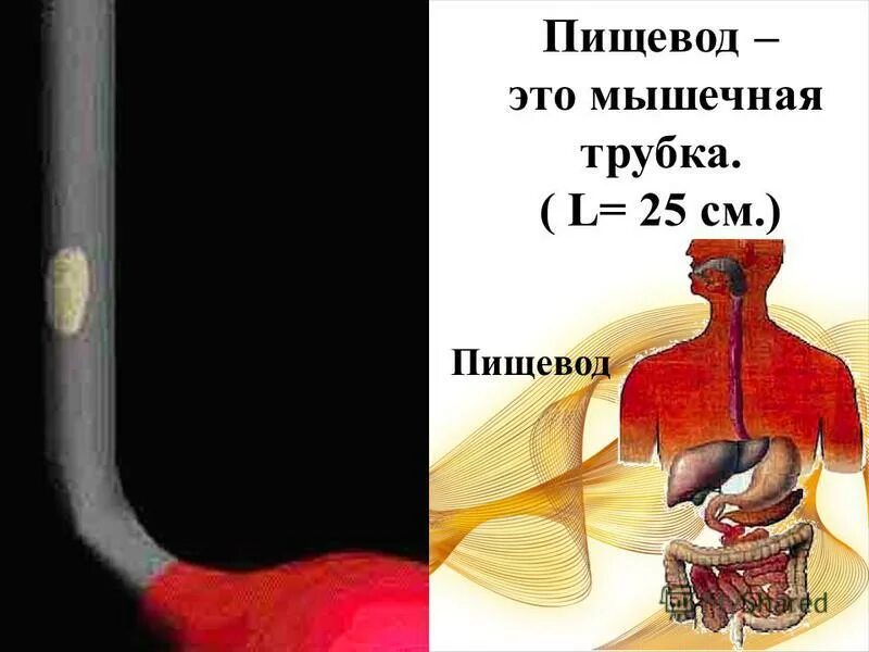 Пищевод это трубка длиной. Пищевод это трубка длиной. Пищевод это мышечная трубка. Пищевод состоит из 3 частей. Пищевод это мышечная трубка.