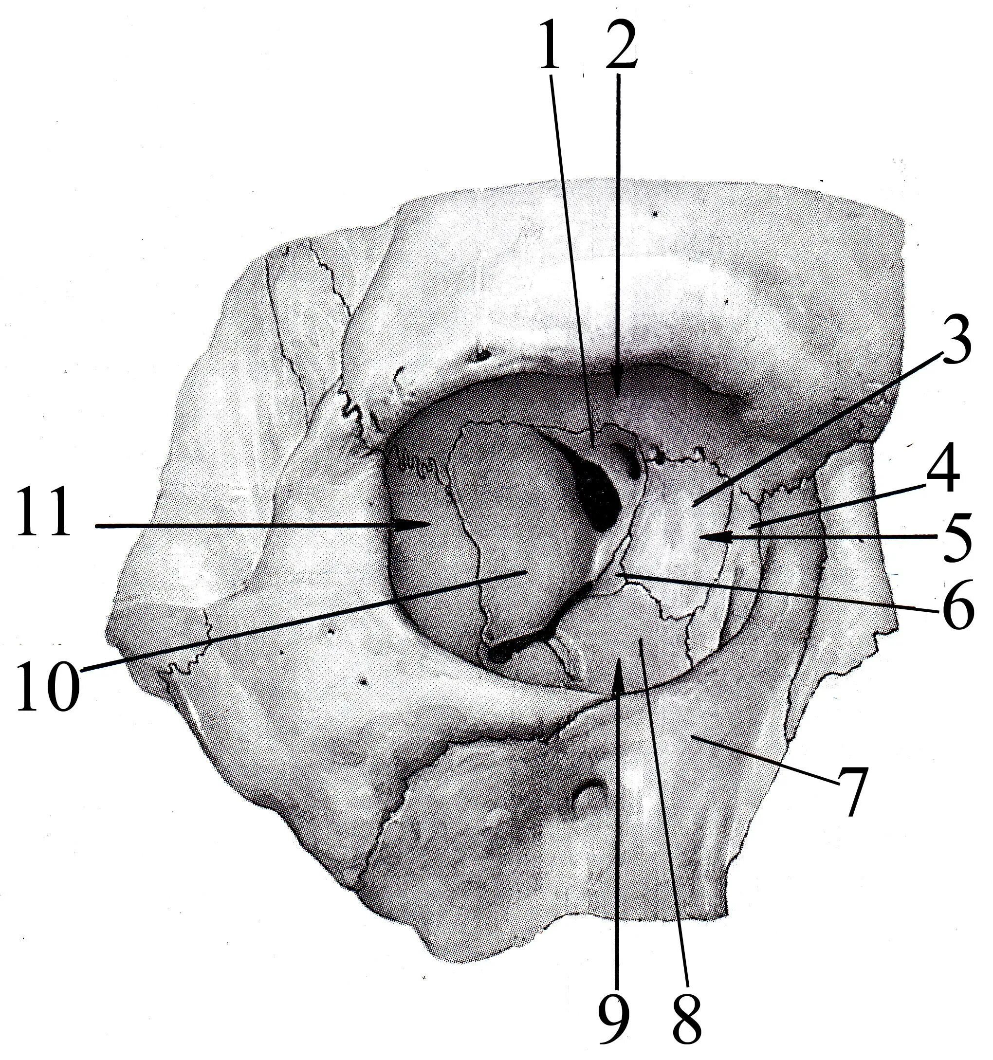 Части глазницы. Орбита глазница анатомия. Строение стенок глазницы. Глазничная кость анатомия. Костные стенки глазницы анатомия.