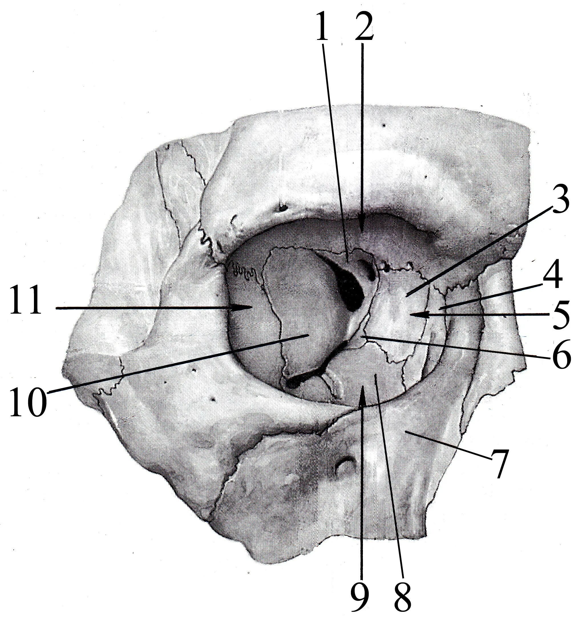 Сообщения глазницы. Строение стенок глазницы. Глазница анатомия Синельников. Костные стенки глазницы анатомия. Глазница стенки кости анатомия.