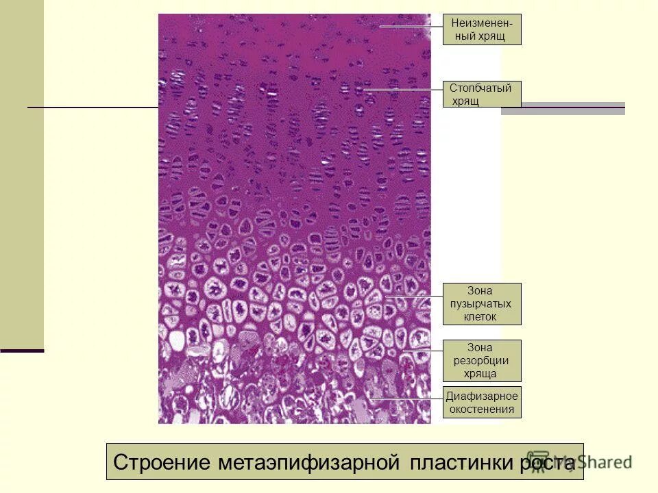 хрящевая ткань хондроциты и хондробласты. хрящевая ткань это соединительная ткань.