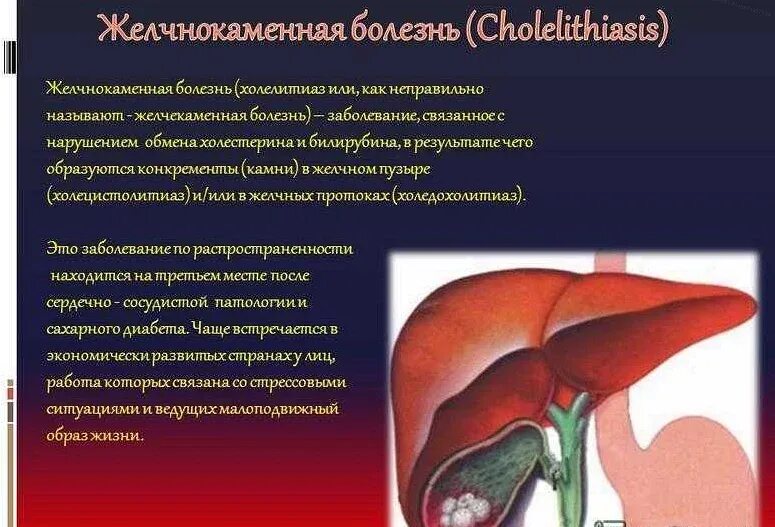 Если нет желчного пузыря. Желчный пузырь при желчекаменной болезни. желчекаменная болезнь(жкб) симптомы. заболевания печени и желчного. болезни печени и желчного пузыря.