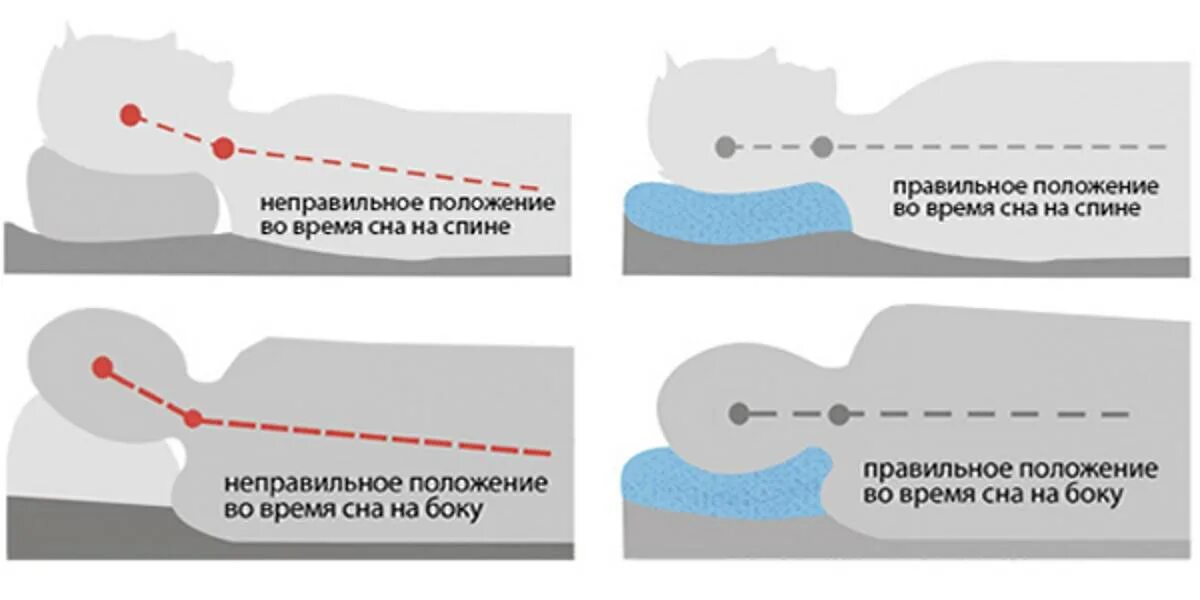 Остеохондроз спать без подушки. Правильное положение для сна. Правильное положение тела во время сна. Правильное положение позвоночника во время сна. Правильное положение для сна при шейном остеохондрозе.