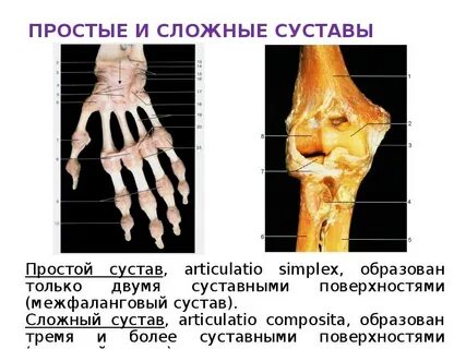 Простой сложный комбинированный комплексный сустав