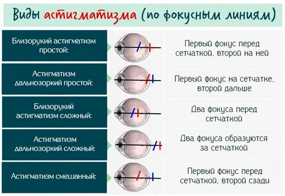 Как обозначается левый глаз