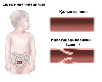 Жас модельдер жезөкшелер