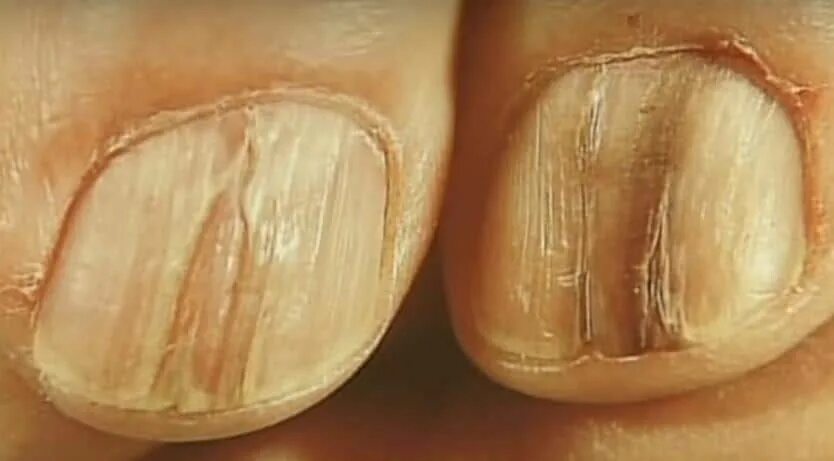 Матрикс ногтевое ложе. Расщепление матрикса. Расщепление матрикса. Кислородное расщепление в митохондриях. Кислородное расщепление (аэробное дыхание):.