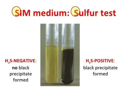 Test medium