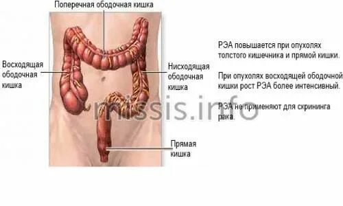 Онкомаркер толстой кишки и кишечника. Поперечно ободочная кишка анатомия. восходящая поперечная кишка. поперечно ободочная кишка пальпация норма. пальпация поперечно ободочной кишки.