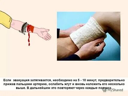 Через какое время следует снять жгут