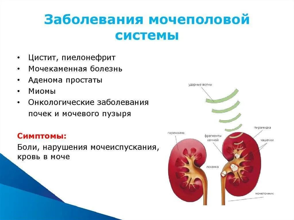 Пиелонефрит мочевого пузыря. Почечные симптомы при заболеваниях мочевыделительной системы. Мочевыделительная система заболевания пиелонефрит. Причины и виды заболеваний выделительной системы. Назовите основные симптомы болезней мочевыделительной системы..