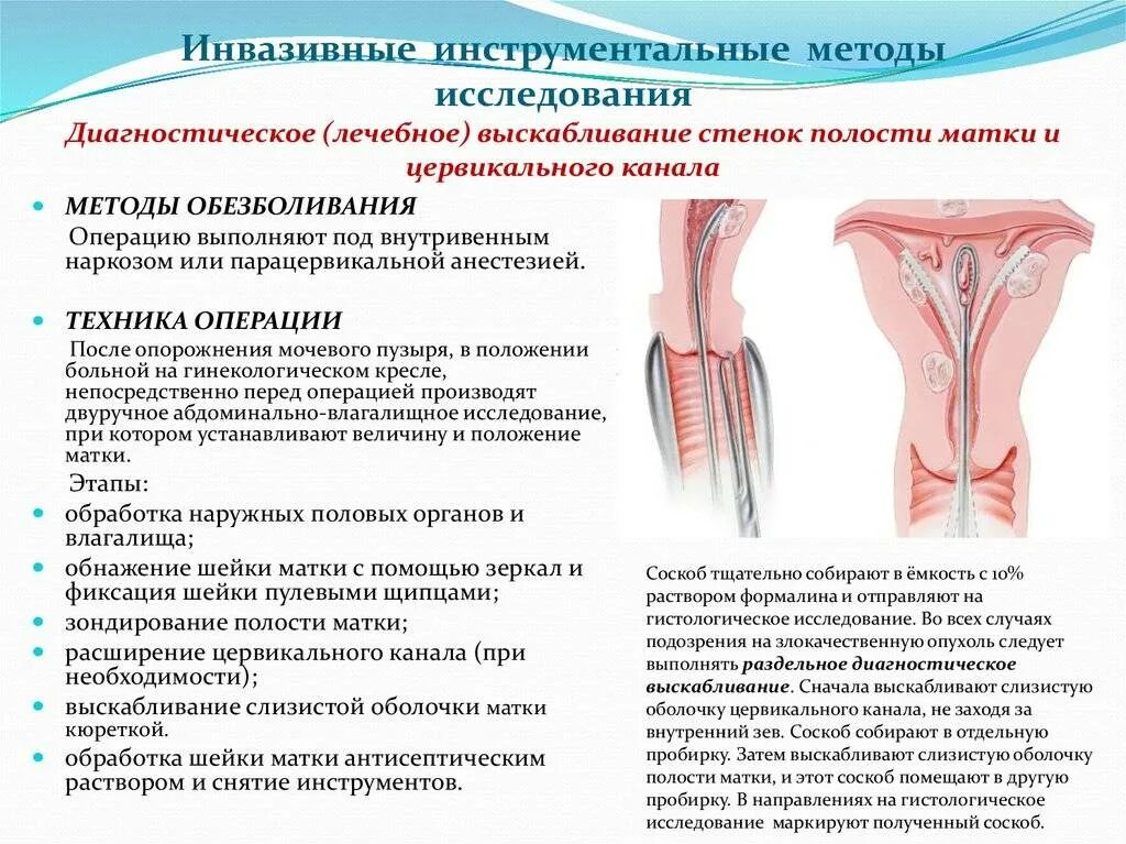 Выскабливание матки цервикального канала. Диагностическое выскабливание полости матки алгоритм. раздельное диагностическое выскабливание полости матки. диагностическое выскабливание полости матки гистология. раздельное диагностическое выскабливание цервикального канала.