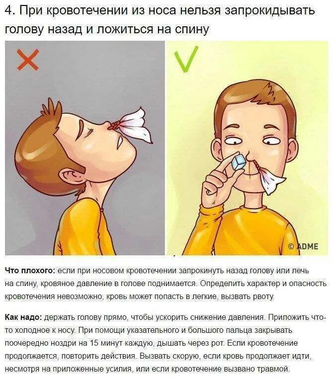 Как укрепить нос при кровотечении. При кровотечении из носа. при кровотечении из носа необходимо. остановить кровь изиноса. остпвновать кровь из носа.
