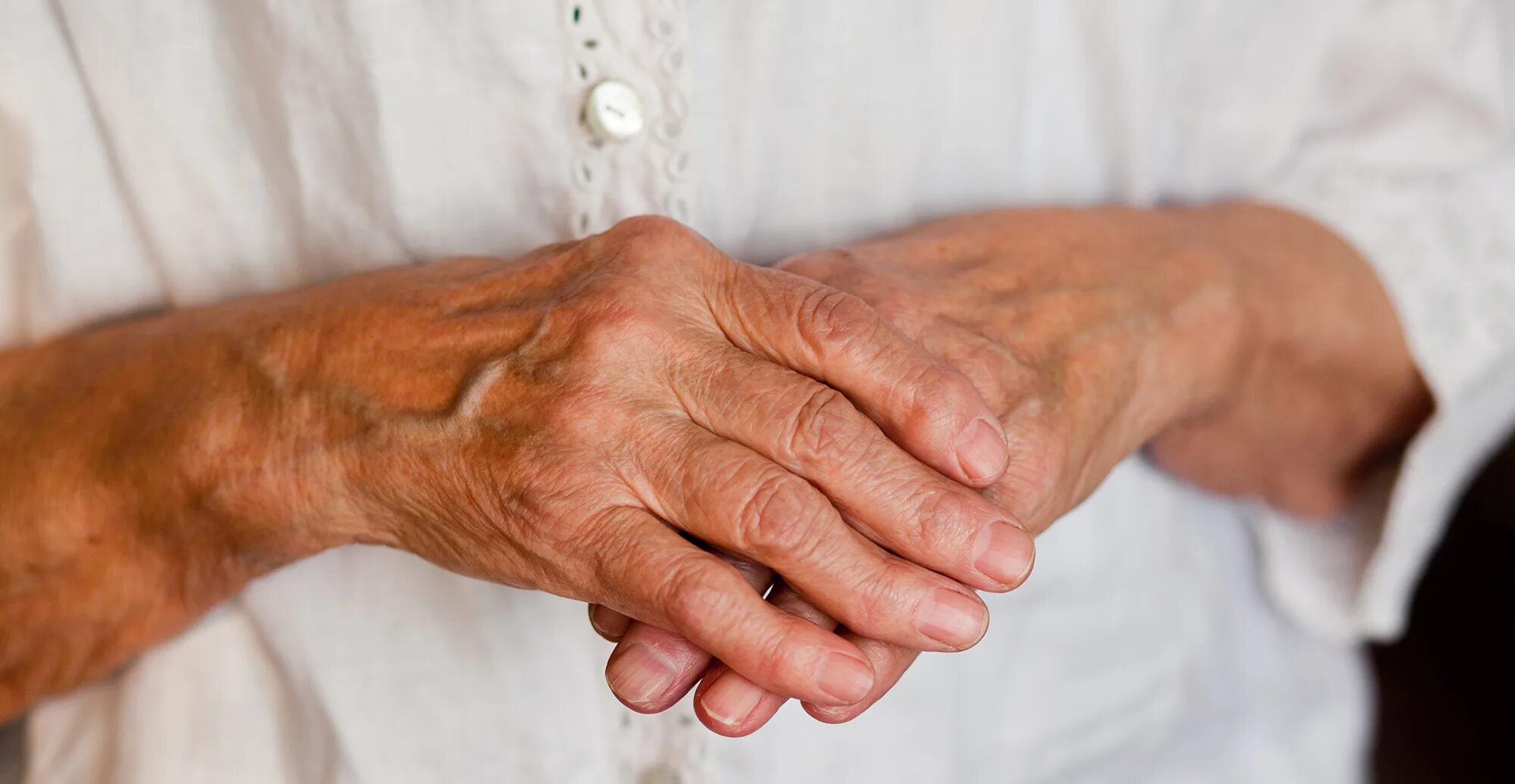 Суставно висцеральная форма ревматоидного артрита. Бруцеллезный полиартрит. Ювенильный псориатический артрит. Псориазный ревматоидный артрит. Полиартроз неуточненный.