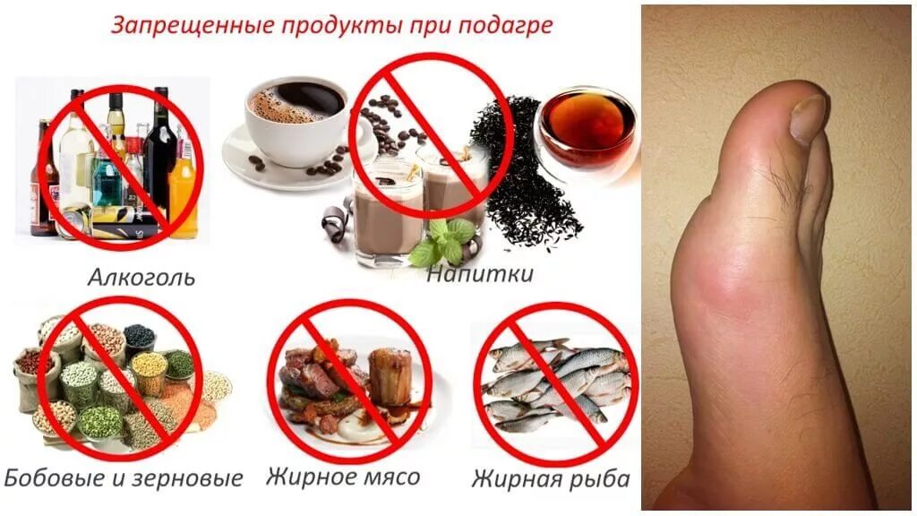 Пьющий подагра