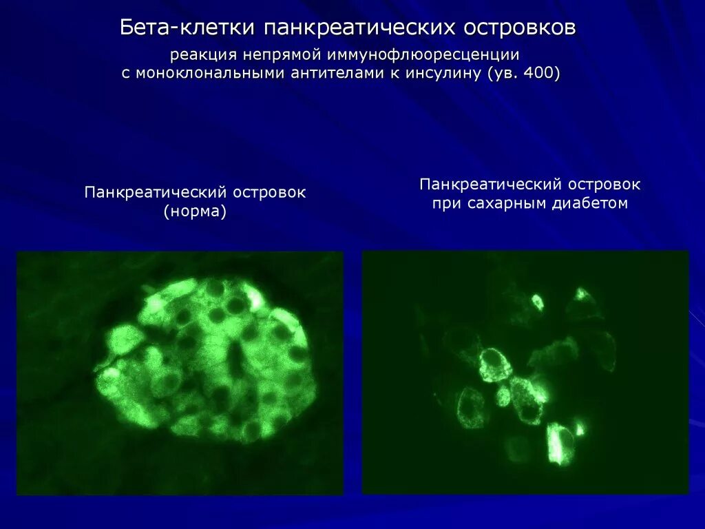 Реакция иммунофлюоресценции непрямой метод. Реакция прямой иммунофлуоресценции микробиология. Реакция иммунофлуоресценции микробиология. Реакция иммунофлюоресценции (прямой и непрямой методы). Называют обладают флюоресцируют