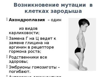 Карликовость у плода