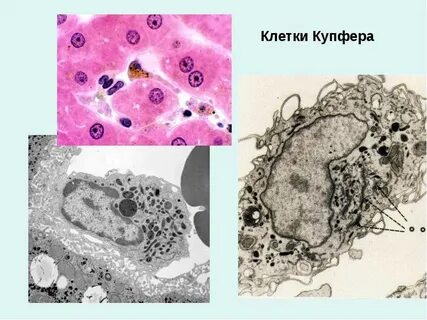 Клетки купфера в печени