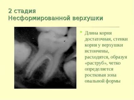 На верхушке корня какая ткань