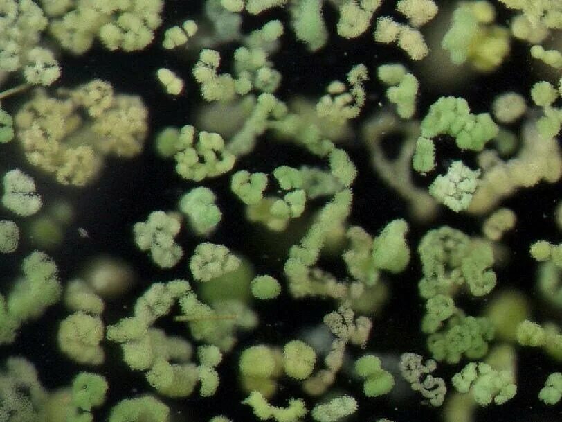 Цианобактерии микроскоп. Синезеленые водоросли микроцистис. Цианобактерии водоросли. Цианобактерия анабоена.