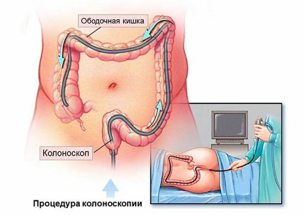 Как проверить тонкую кишку